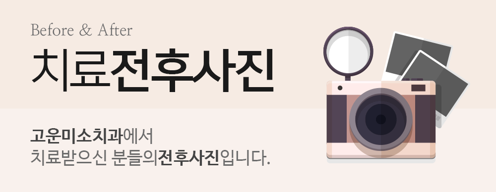 치료전후사진